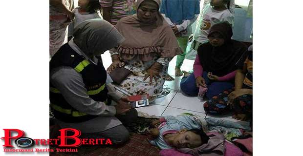 Sejak 3 Tahun Bocah Ini Terbujur Kaku..