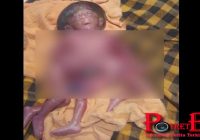 Warga Berkumpul Melihat Bayi Bertangan Dan Berkaki Empat