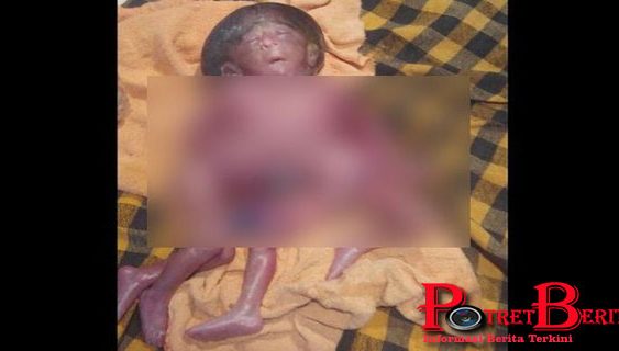 Warga Berkumpul Melihat Bayi Bertangan Dan Berkaki Empat