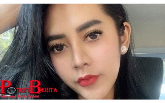Selain Vernita Syabilla, Kasus Bau Ikan Asin juga Dialami Fairuz A Rafiq