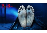 Seorang Pengemis di India Ditemukan Tewas, Jantungnya Berubah Jadi Batu