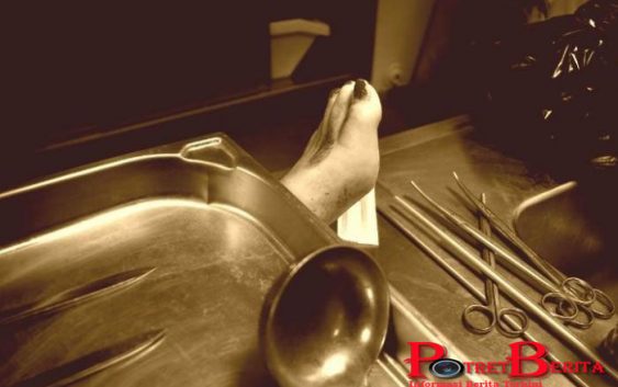 Sadis! Seorang Wanita Tega Bunuh Pacar dan Mutilasi, Simpan Jasad di Kulkas